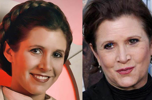 Carrie Fisher’s Plastic Surgery